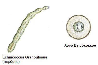 Εχινόκοκκος κύστη