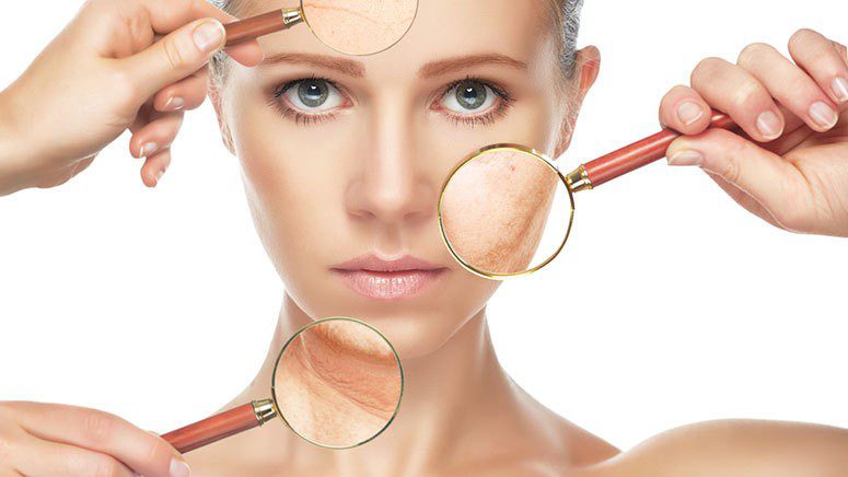 Φωτογήρανση