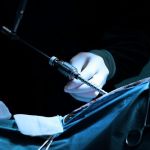 Ομφαλοκήλη5