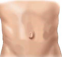 ομφαλοκήλη