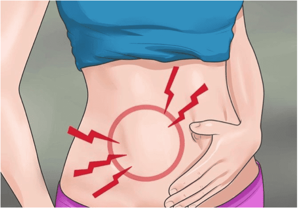 Οξεία Σκωληκοειδίτιδα