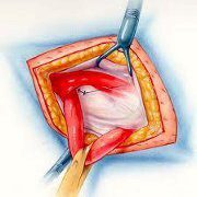 vouvonokyli3_180x180